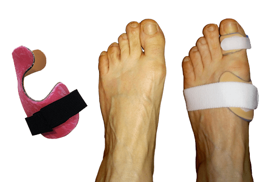 Orthèse de contention nocturne pour hallux valgus